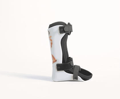Orthèse cheville-pied Morsa Cyberg pour enfant, modèle 130.381. Orthèse protectrice et stable, disponible en tailles S, M, L. Conçue pour favoriser le développement sain de la marche.