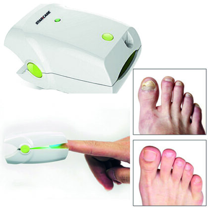 Appareil Starcare pour le traitement des mycoses des ongles et orteils, utilisant la lumière rouge/infrarouge. Design compact et ergonomique.
