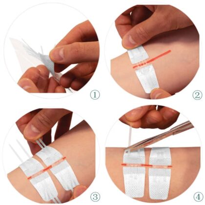 Pansement de sutures rectangulaire blanc, mesurant 8x2 cm, de la marque Starcare. Le pansement semble flexible et légèrement texturé. Il est présenté sur un fond neutre, mettant en valeur sa forme et sa taille. Le pansement est conçu pour la cicatrisation de petites plaies, offrant une protection et une ventilation optimale.