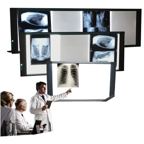 Négatoscope LED StarCare, affichant une image médicale amplifiée et claire. Design plat et compact. Quatro magnifications (x40). Conçu pour une utilisation professionnelle aisée et robuste.