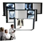 Négatoscope LED StarCare : appareil d'observation médical portable. Affichage avec deux plages d'observation. Éclairage LED doux et sans chaleur. Design fin et plat. Idéal pour les diagnostics en parapharmacie et dans le domaine de la santé.